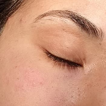 Garnier Asla Beğenmedim Yüzüme Alerji Yaptı