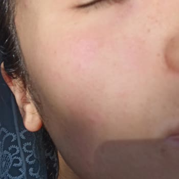 Garnier Asla Beğenmedim Yüzüme Alerji Yaptı