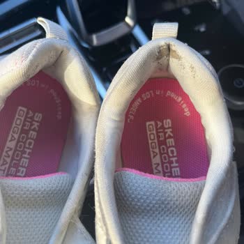 Sketchers Ayakkabıda Kalite Sorunu: 1 Ayda Yırtılma!