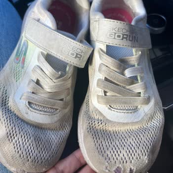 Sketchers Ayakkabıda Kalite Sorunu: 1 Ayda Yırtılma!