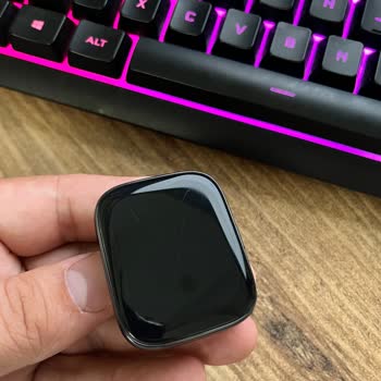 Xiaomi Servisinizin Verdiği Hizmete Bir De Siz Bakın