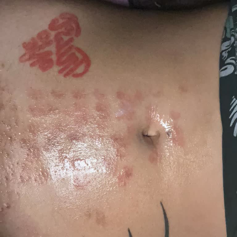 Ankara Cerrahi Tıp Merkezi Güzellik Kliniğinde Yanık Sorunu Ve Müşteriye Yaklaşım Hataları