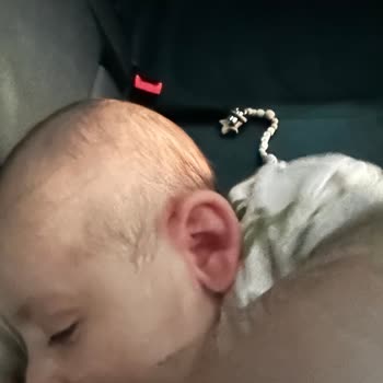 Sma Comfort 1 Alerji Yaptı