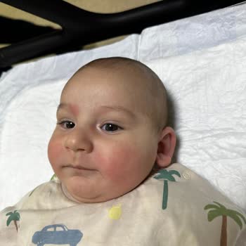 Sma Comfort 1 Alerji Yaptı