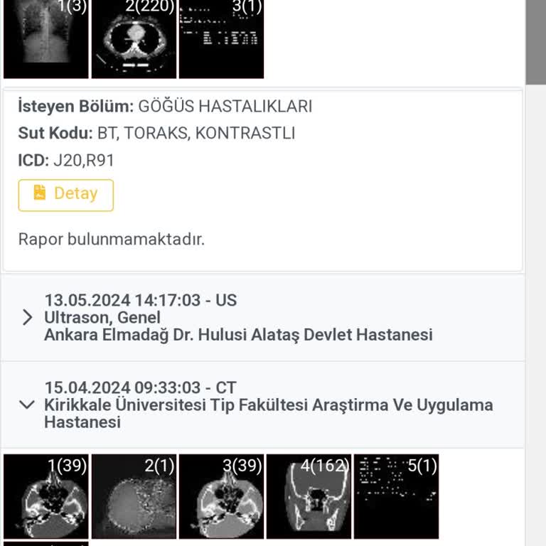 Kırıkkale Tıp Fakültesi İlaçlı Tomografi Raporu Gecikmesi