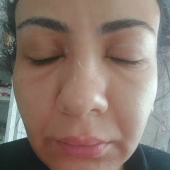 Procsin Yuz Yikama Jeli Felaketim Oldu