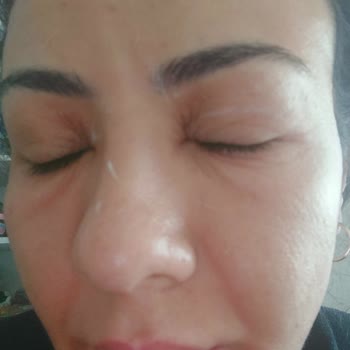 Procsin Yuz Yikama Jeli Felaketim Oldu