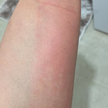 Maruderm Yüz Yıkama Jeli Yüzümü Mahvetti