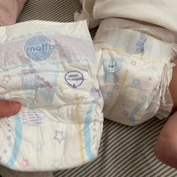 Molfix Ayıplı Bebek Bezi