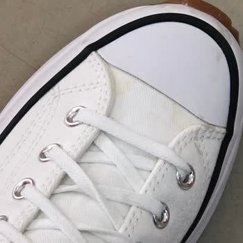 Converse Sarı Leke Oluştu
