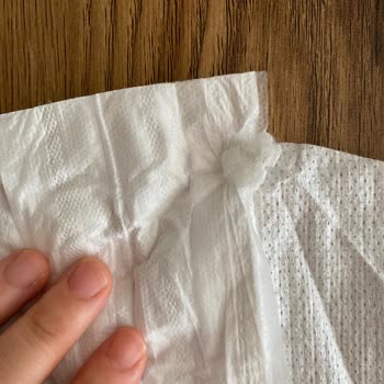 Molfix Bebek Bezi İçinden Değişik Bir Şey Var