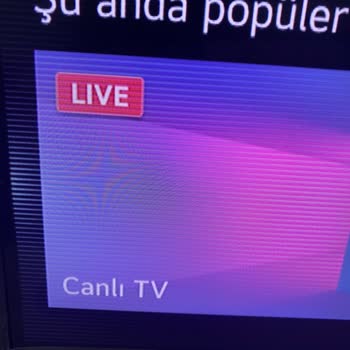 Trendyol Dan Aldığım 1.5 Aylık TV Nokta Ve Çizgi Hatası