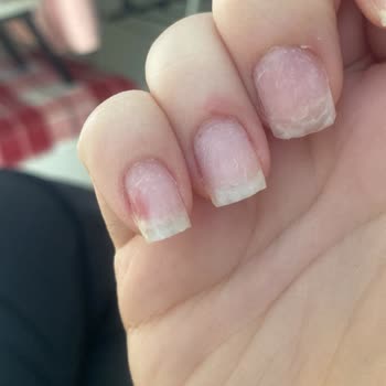 Tuğba Yeşilova Güzellik Protez Tırnaklarının Bir Haftada Üç Tanesi Kırılmadı, Soyuldu