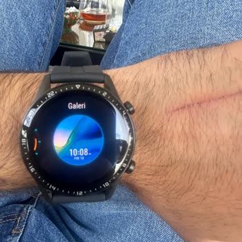 Huawei Uygulamada Sahip Olduklarımda Gallery Gözükmüyor