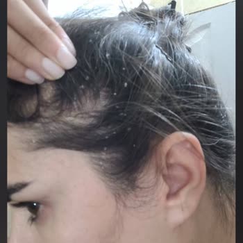 Hair Cnc Bayan Kuaförü Saç Bakımı Sonrası Yaşanan Olumsuz Deneyim