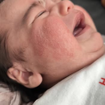 Mustela Temizleme Losyonu Şikayeti