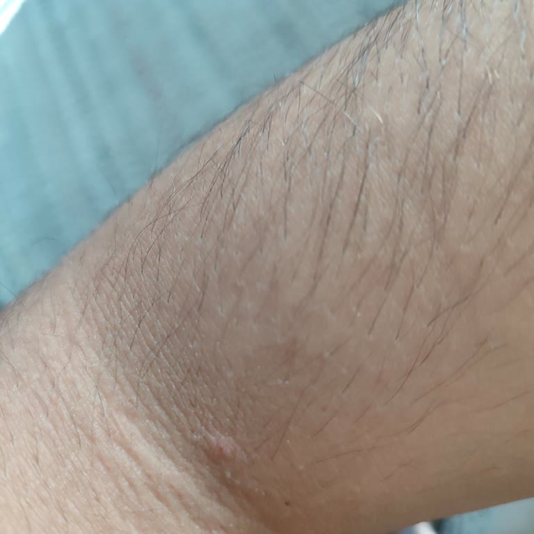 Çankırı Çerkeş Devlet Hastanesi Hastane Ziyaretimde Yaşadığım Tatsız Deneyim