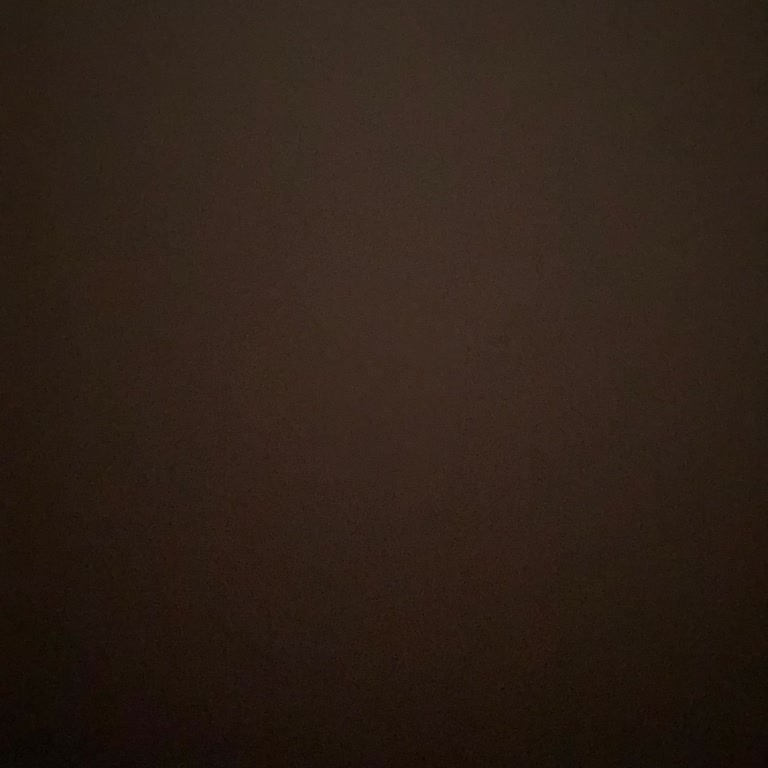 Türk Telekom Hattın Çekme Sorunu