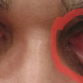 Medical Park Hastanesi Hastane İşleyişindeki Aksaklıklar Ve Mağduriyetim