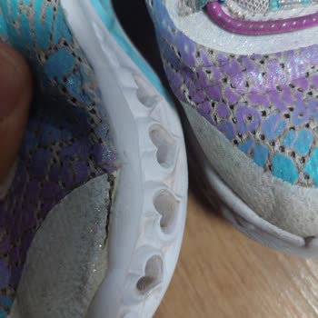 Skechers Ayakkabının 1 Aylık Hali