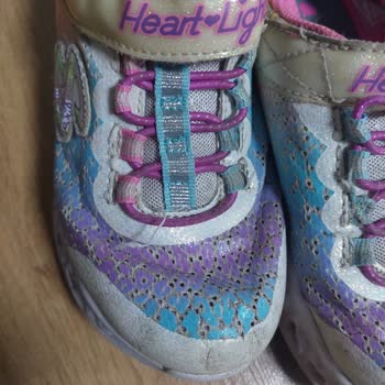 Skechers Ayakkabının 1 Aylık Hali