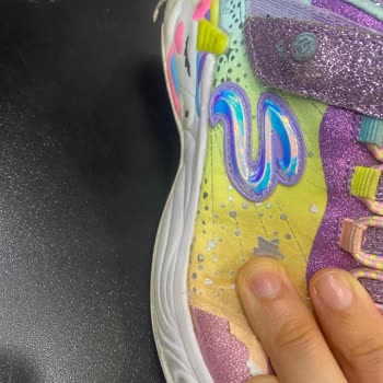 Skechers Çocuk Spor Ayakkabısında Beklenmedik Deformasyon