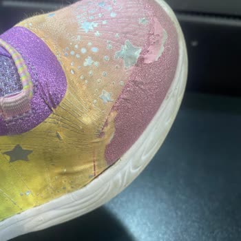 Skechers Çocuk Spor Ayakkabısında Beklenmedik Deformasyon