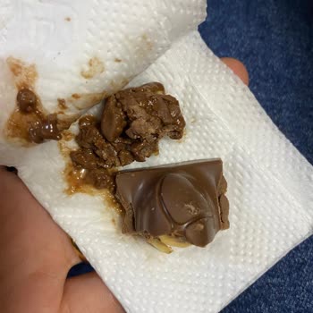 Ülker Çikolatam Küflü Çıktı