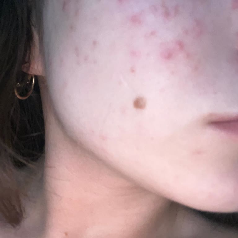 Maruderm Yüz Yıkama Jeli Cildimi Mahvetti