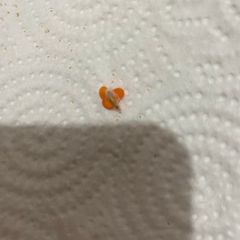 Öncü Bakliyat Kritik Gıda Güvenliği Öncü Marka