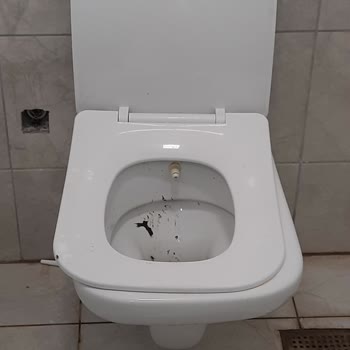 Mardin Eğitim ve Araştırma Hastanesi Hastane Tuvaletlerinde Gerekli Temizlik Ve Özen Sağlansın.