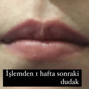 Büşra Karagöz Brows Dudak Renklendirme Hizmetinden Beklenen Sonuç Alınamadı