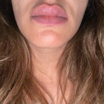 Flormar Silk Matte Alerji Yaptı