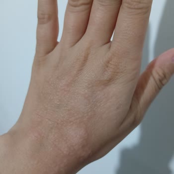 Komili Kişisel Bakım Komili Zeytinyağlı Sıvı Sabun Ellerimde Alerjiye Neden Oldu