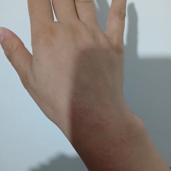 Komili Kişisel Bakım Komili Zeytinyağlı Sıvı Sabun Ellerimde Alerjiye Neden Oldu