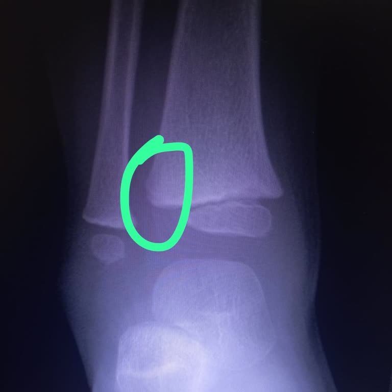 Sancaktepe Bölge Hastanesi Yanlış Teşhis Konuldu