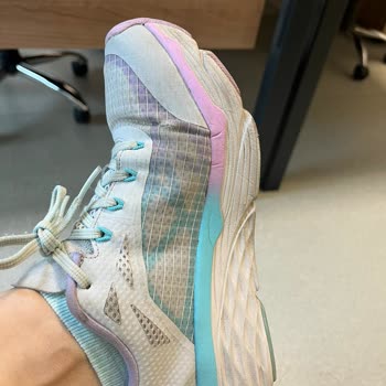 Skechers Kusurlu Üretim Ve Yırtılma