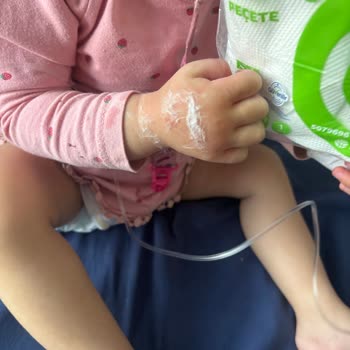 İnova Hastanesi Yeni Taşındığımız Aksaray'da Kızımın Yaşadığı Sağlık Sorunları!