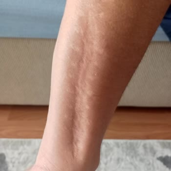 Akdeniz Şifa Hastanesi Özel Hastane De Yaşanan Mağduriyet