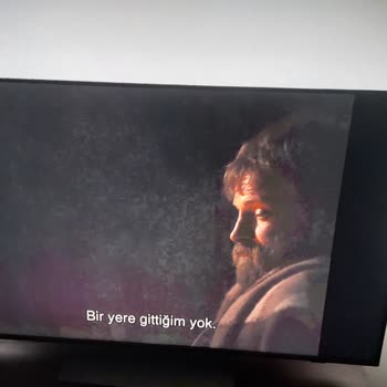 PHILIPS TV Philips 65PUS8808 Panel Problemi, Renk Dağıtması, Puslu Görüntü