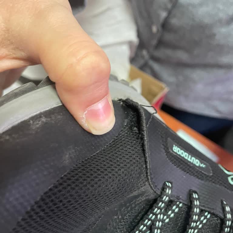 Skechers Sökülen Ayakkabı Kullanıcı Hatasıymış