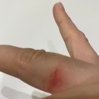 Lizay Pırlanta Tam Tur Parmağımı Yara Yaptı