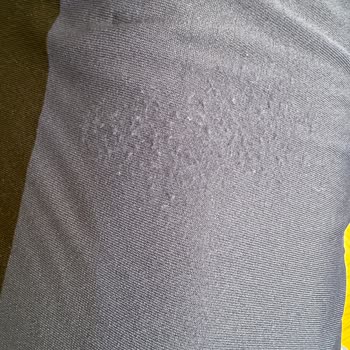 Network 3 Günlük Üründe Kullanıcı Hatası Buldu...!