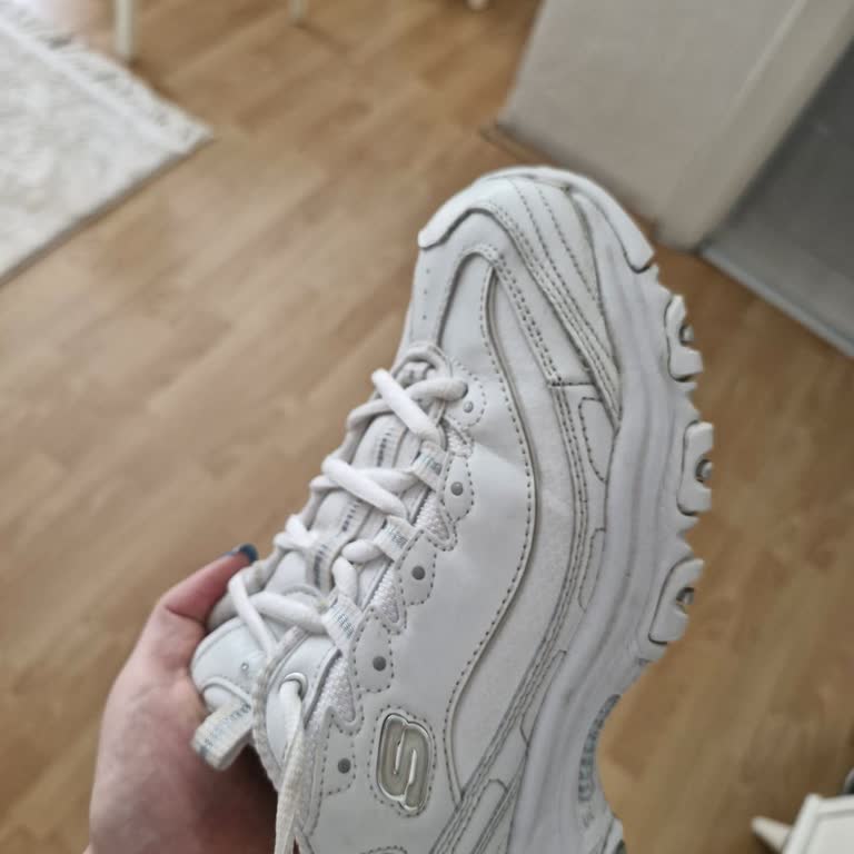 Skechers Ayakkabı İki Giyimde Yırtıldı