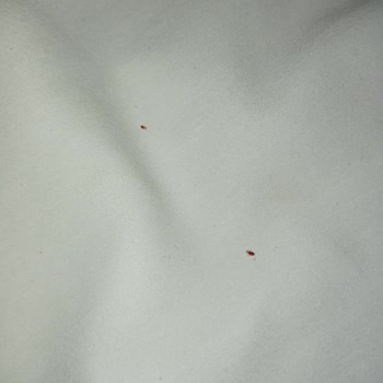 Looks Hotel Manisa Tahtakurusu Sorunu