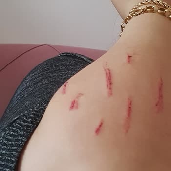 Beko Fırın Camı Patlaması