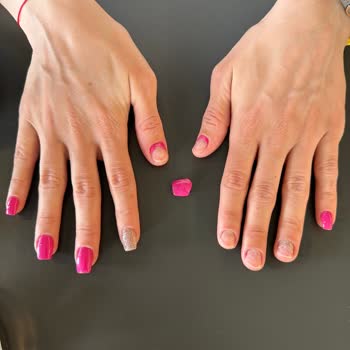 Beauteoz Güzellik Merkezi Protez Tırnak Sorunu Ve Müşteri Mağduriyeti