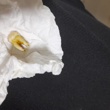 Oba Makarnasından Diş Çıktı