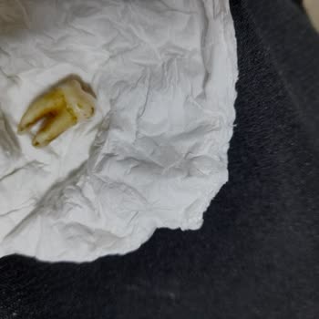 Oba Makarnasından Diş Çıktı