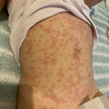 Büyük Anadolu Hastanesi Darıca Yaşatılan Mağduriyet!